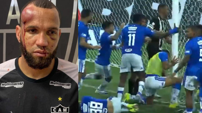 Brutal batalla campal en Brasil que acaba con 23 jugadores expulsados y graves lesiones