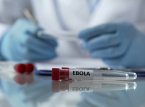 OMS: "La propagaci&oacute;n del &eacute;bola est&aacute; superando actualmente los esfuerzos de contenci&oacute;n"