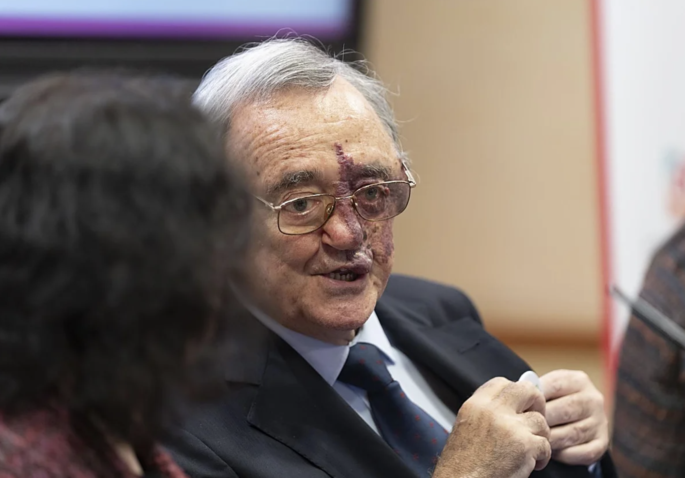 Científicos españoles logran la erradicación completa del cáncer de páncreas gracias a la combinación de 3 fármacos