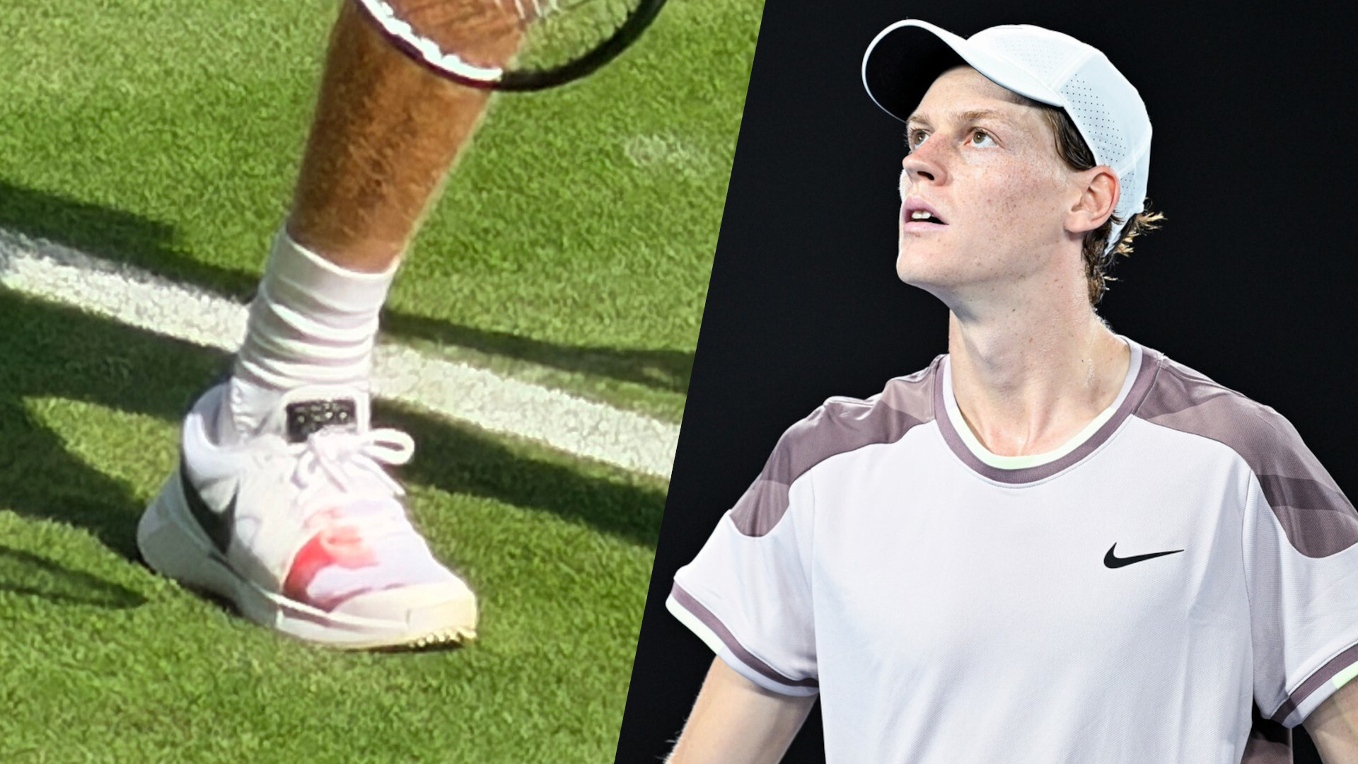 Jannik Sinner explica sus zapatillas manchadas de sangre en Wimbledon